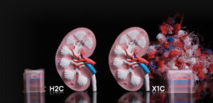 PC1 | Avloon Two pink kidney models with exposed internal vessels labeled H2C and X1C against a black background with tangled red blue fibers on the right